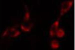 ABIN6266697 staining HeLa cells by IF/ICC. (PDZD2 anticorps  (N-Term))