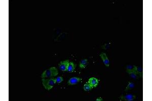 Immunofluorescent analysis of HepG2 cells using ABIN7170313 at dilution of 1:100 and Alexa Fluor 488-congugated AffiniPure Goat Anti-Rabbit IgG(H+L)