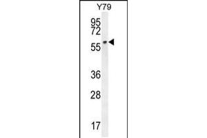 Western blot analysis in Y79 cell line lysates (35ug/lane). (LCO anticorps  (C-Term))