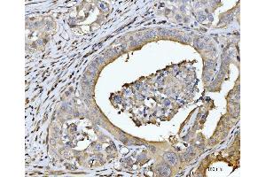 IHC analysis of EDEM3 using anti-EDEM3 antibody (ABIN7602003). (EDEM3 anticorps  (AA 54-795))