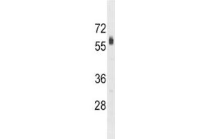 SPHK2 antibody western blot analysis in HepG2 lysate.