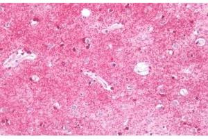 Human Brain, Cortex: Formalin-Fixed, Paraffin-Embedded (FFPE)