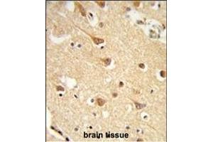 Formalin-fixed and paraffin-embedded human brain tissue reacted with ND2 Antibody (N-term), which was peroxidase-conjugated to the secondary antibody, followed by DAB staining.