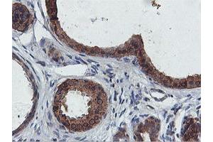 Immunohistochemical staining of paraffin-embedded Human breast tissue using anti-FDFT1 mouse monoclonal antibody.