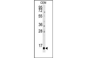 Image no. 1 for anti-Prefoldin Subunit 6 (PFDN6) (C-Term), (N-Term) antibody (ABIN358008) (PFDN6 anticorps  (C-Term, N-Term))