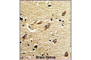 Formalin-fixed and paraffin-embedded human brain tissue reacted with ND5 Antibody (C-term), which was peroxidase-conjugated to the secondary antibody, followed by DAB staining.