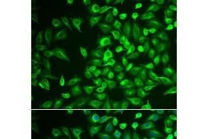 Immunofluorescence analysis of U2OS cells using LRat Polyclonal Antibody (LRAT anticorps)