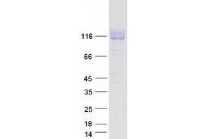 Validation with Western Blot