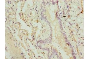 Immunohistochemistry of paraffin-embedded human lung tissue using ABIN7148645 at dilution of 1:100