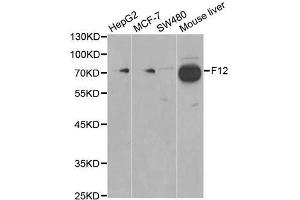 Western blot analysis of extracts of various cell lines, using F12 antibody. (F12 anticorps  (AA 336-615))