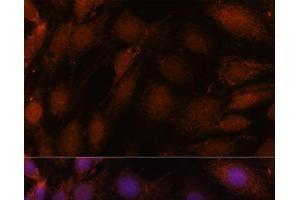 Immunofluorescence analysis of C6 cells using GCAT Polyclonal Antibody at dilution of 1:100. (GCAT anticorps)