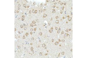 Immunohistochemistry of paraffin-embedded mouse brain using RHOT2 Rabbit pAb (ABIN3016307, ABIN3016308, ABIN1682532 and ABIN6219710) at dilution of 1:50 (40x lens). (RHOT2 anticorps  (AA 280-480))