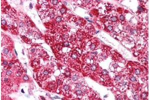 Human Adrenal (formalin-fixed, paraffin-embedded) stained with EIF4G2 antibody ABIN214749 at 5 ug/ml followed by biotinylated goat anti-rabbit IgG secondary antibody ABIN481713, alkaline phosphatase-streptavidin and chromogen.