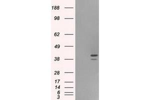 HEK293T cells were transfected with the pCMV6-ENTRY control (Left lane) or pCMV6-ENTRY ILF2 (Right lane) cDNA for 48 hrs and lysed. (ILF2 anticorps)