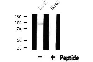 Western blot analysis of extracts from HepG2, using SOX6 Antibody.