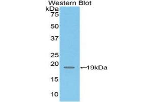 Detection of Recombinant CD97, Mouse using Polyclonal Antibody to Cluster Of Differentiation 97 (CD97) (CD97 anticorps  (AA 32-173))