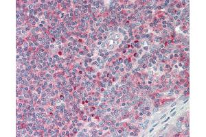 anti-Lysine (K)-Specific Demethylase 6A (KDM6A) (AA 245-294) antibody