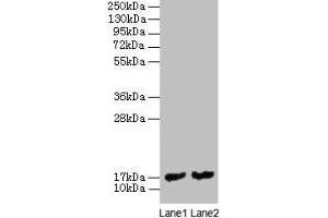 Western blot All lanes: mpt63 antibody at 2 μg/mL Lane 1: Recombinant Mycobacterium tuberculosis Immunogenic protein MPT63 protein 1 μg Lane 2: Recombinant Mycobacterium tuberculosis Immunogenic protein MPT63 protein 0. (MPT63 anticorps  (AA 30-159))