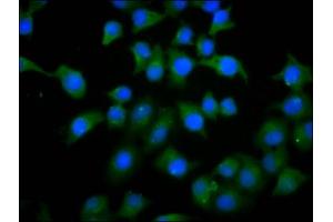 Immunofluorescence staining of A549 cells with ABIN7163100 at 1:133, counter-stained with DAPI. (PHACTR1 anticorps  (AA 263-387))