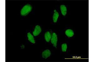 Immunofluorescence of purified MaxPab antibody to DMAP1 on HeLa cell. (DMAP1 anticorps  (AA 1-467))