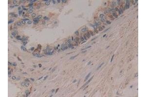 Detection of CYCS in Human Prostate Tissue using Polyclonal Antibody to Cytochrome C (CYCS)