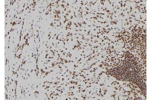 ABIN6273826 at 1/100 staining Human gastric tissue by IHC-P. (Becn2 (N-Term) anticorps)