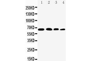 Anti-NF-kB p65 antibody, Western blotting Lane 1: Rat Testis Tissue Lysate Lane 2: HELA Cell Lysate Lane 3: A431 Cell Lysate Lane 4: JURKAT Cell Lysate