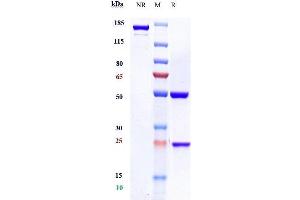 Anti-CD20 Reference Antibody (rituximab) on SDS-PAGE under reducing (R) condition. (Recombinant MS4A1 (Rituximab Biosimilar) anticorps)