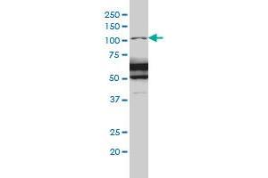 RASA1 monoclonal antibody (M01A), clone 2C12 Western Blot analysis of RASA1 expression in IMR-32 . (RASA1 anticorps  (AA 948-1047))