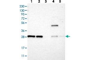Western blot analysis of Lane 1: RT-4, Lane 2: U-251 MG, Lane 3: Human Plasma, Lane 4: Liver, Lane 5: Tonsil with TMEM234 polyclonal antibody  at 1:250-1:500 dilution. (TMEM234 anticorps)