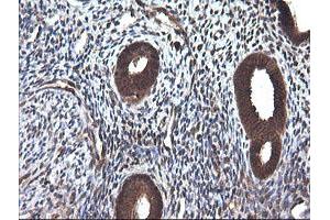 Image no. 1 for anti-Cancer/testis Antigen 1B (CTAG1B) antibody (ABIN1499906) (CTAG1B anticorps)