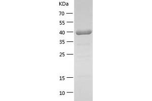 Western Blotting (WB) image for Mitogen-Activated Protein Kinase 14 (MAPK14) (AA 1-360) protein (His-IF2DI Tag) (ABIN7123993)