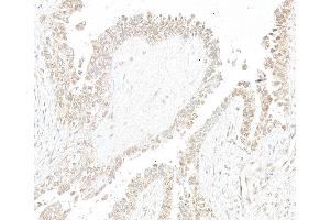 anti-Cullin 3 (CUL3) (AA 650-700) antibody