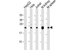 All lanes : Anti-NDUFB9 Antibody (Center) at 1:2000 dilution Lane 1: HepG2 whole cell lysate Lane 2: Hela whole cell lysate Lane 3: Jurkat whole cell lysate Lane 4: mouse kidney lysate Lane 5: mouse spleen lysate Lysates/proteins at 20 μg per lane. (NDUFB9 anticorps  (AA 97-131))