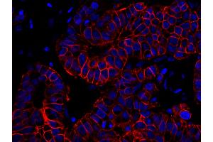 Immunofluorescence (IF) image for anti-Receptor tyrosine-protein kinase erbB-2 (ErbB2/Her2) (C-Term) antibody (ABIN7448962) (ErbB2/Her2 anticorps  (C-Term))