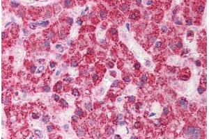 Human Liver: Formalin-Fixed, Paraffin-Embedded (FFPE)