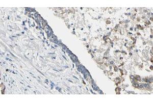 ABIN6268658 at 1/100 staining Human prostate tissue by IHC-P. (PIK3CA anticorps  (Internal Region))
