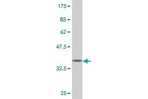 Western Blot detection against Immunogen (37. (Spastin anticorps  (AA 200-304))