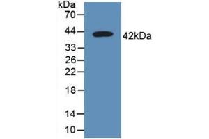 Detection of Recombinant CD63, Human using Polyclonal Antibody to Tetraspanin 30Cluster of Differentiation 63 (CD63) (CD63 anticorps  (AA 103-203))