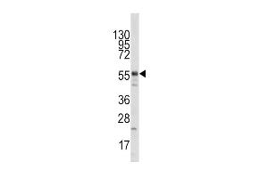 Western blot analysis of anti-HTATIP Pab (ABIN387933 and ABIN2844453) in mouse liver tissue lysate (35 μg/lane).