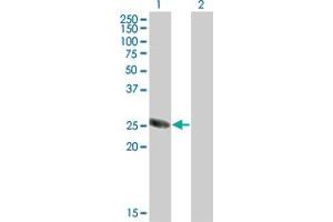 Western Blot analysis of TSSK3 expression in transfected 293T cell line by TSSK3 monoclonal antibody (M07), clone 6B2.
