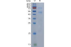 Human Protein, His Tag on SDS-PAGE under reducing condition.