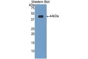 Western blot analysis of the recombinant protein. (Cardiac Troponin T2 anticorps  (AA 2-100))