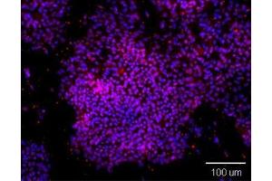 Immunofluorescence analysis of paraformaldehyde-fixed human embryonic stem cell, using OCT3/4 antibody at 1:100 dilution, costained with DAPI.