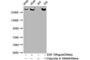 Western Blot Positive WB detected in A549 whole cell lysate,293 whole cell lysate(treated with Calyculin A or EGF) All lanes Phospho-MTOR antibody at 1. (Recombinant MTOR anticorps  (pSer2481))