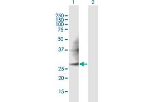 Western Blot analysis of PMM2 expression in transfected 293T cell line ( H00005373-T01 ) by PMM2 MaxPab polyclonal antibody.