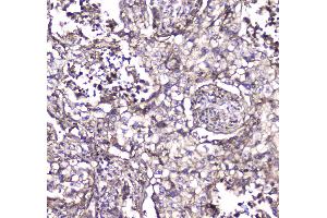 IHC analysis of S100A10 using anti-S100A10 antibody .
