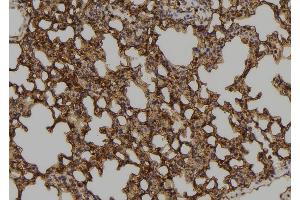ABIN6273575 at 1/100 staining Mouse lung tissue by IHC-P. (ZNF768 anticorps  (Internal Region))