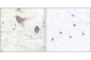 Immunohistochemistry analysis of paraffin-embedded human brain tissue, using Synuclein beta Antibody. (beta Synuclein anticorps  (AA 85-134))