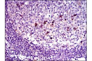 Immunohistochemical analysis of paraffin-embedded lymphoid tissue tissues using TGFb1 mouse mAb with DAB staining.
